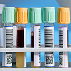 blood tests in test tubes