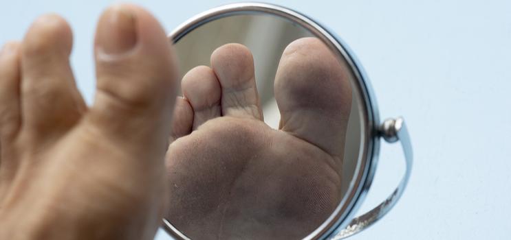 Foot Care PEI - Person looking at the sole of their foot in a mirror