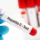 Photo shows a gloved hand holding a vial that says "hepatitic C test"
